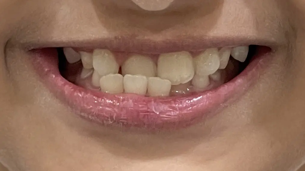 Best Orthodontist In Jumeirah, Dubai 13 10A